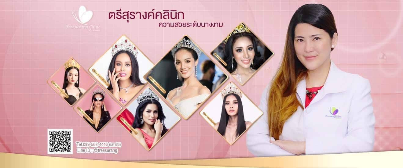 ฟิลเลอร์ จัดอันดับ