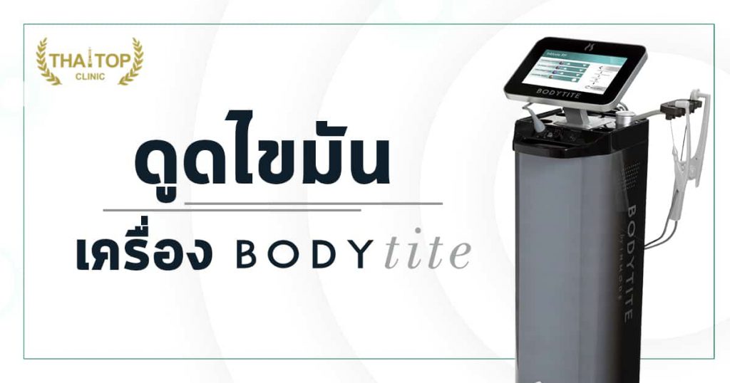 ดูดไขมันBodytite