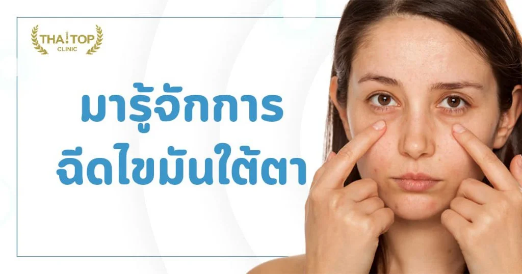 ฉีดไขมันใต้ตา