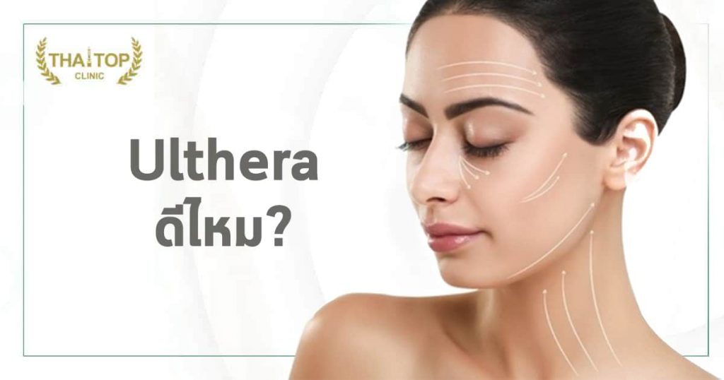 Ulthera ดีไหม
