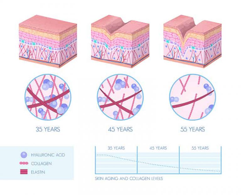 Hyaluronic Acid เป็นอย่างไร