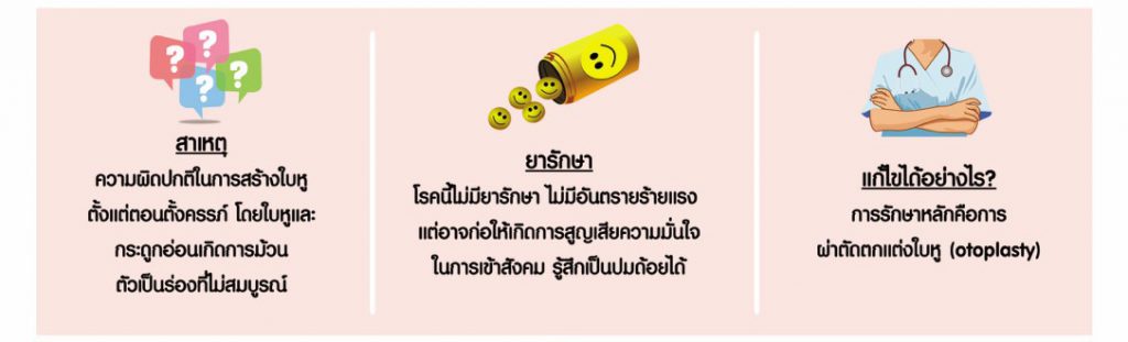 ศัลยกรรมหูกาง ดีไหม
