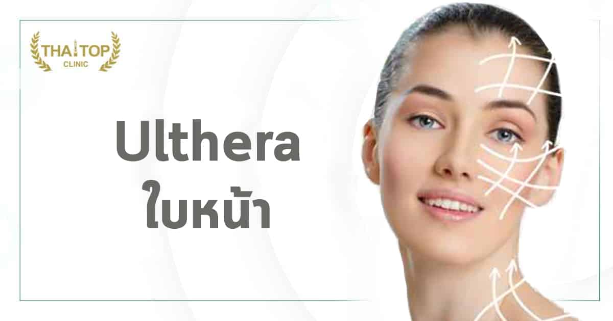 Ulthera ใบหน้า