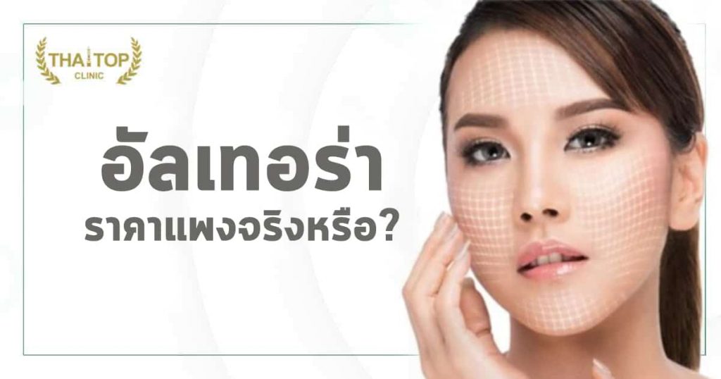 อัลเทอร่า ราคาแพง