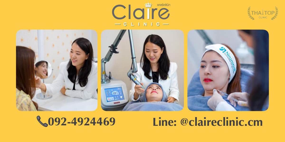 รักษาหลุมสิว Claire Clinic