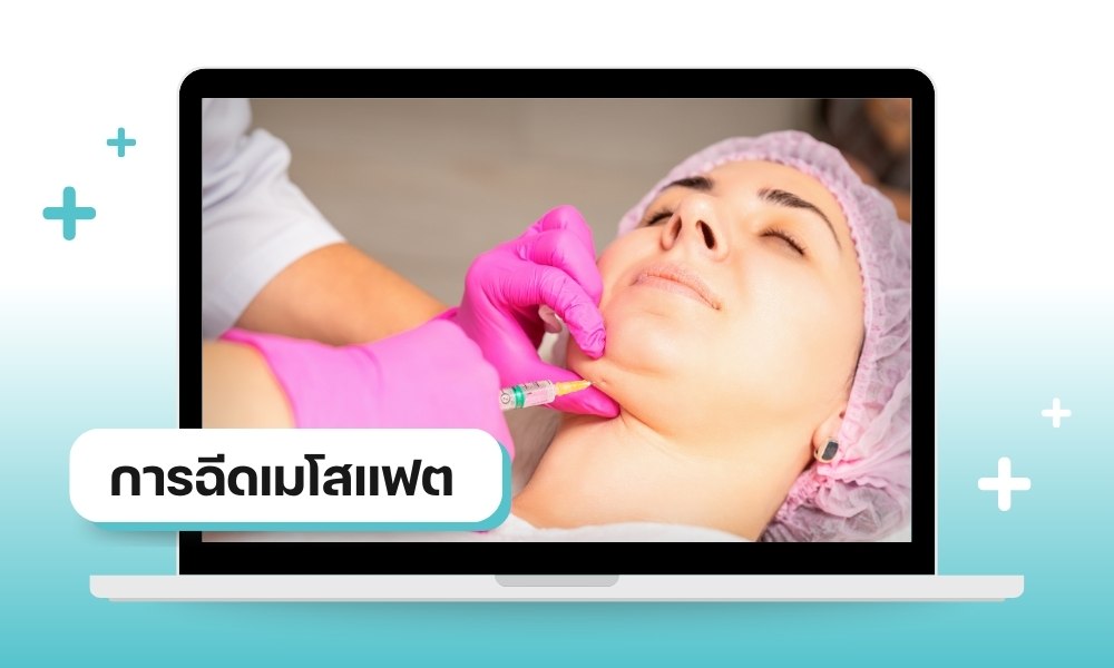 การฉีดเมโสแฟต ปรับรูปหน้า