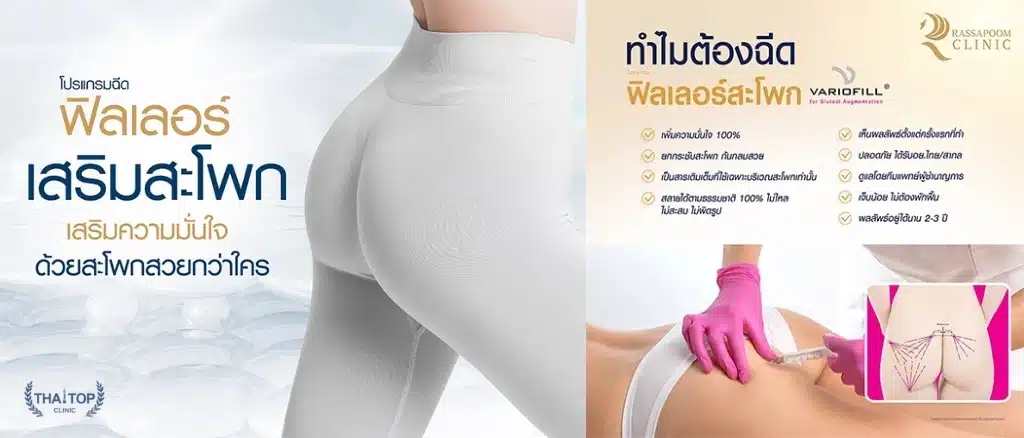 Rassapoom Clinic ฟิลเลอร์สะโพก