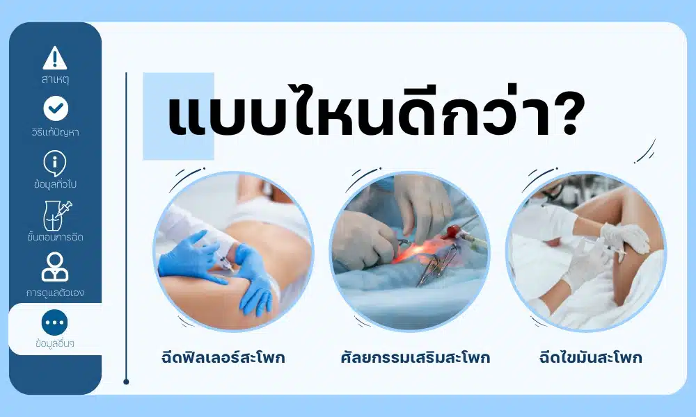 ฉีดฟิลเลอร์สะโพก กับ ศัลยกรรมเสริมสะโพก และการฉีดไขมันสะโพก