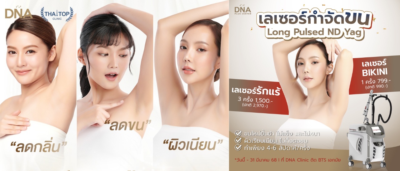 เลเซอร์ขนที่ DNA Skin Clinic