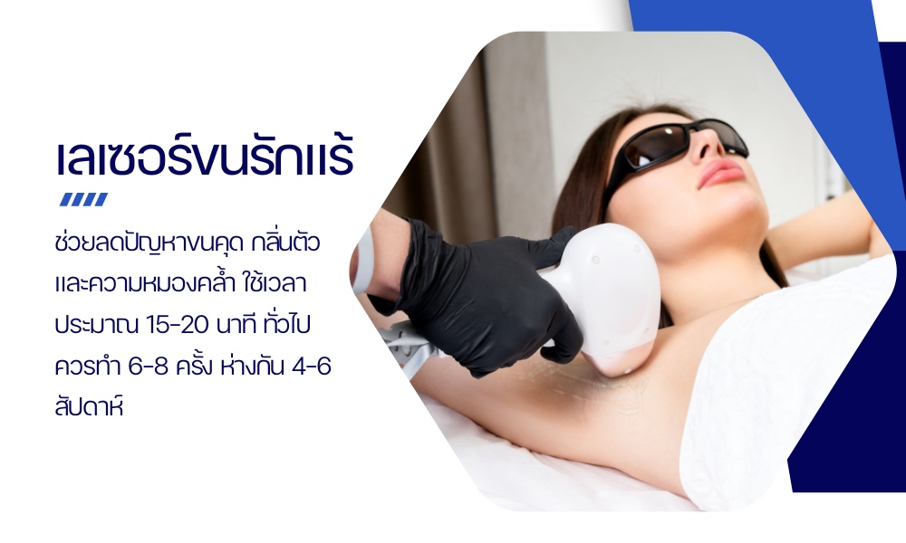เลเซอร์ขนรักแร้
