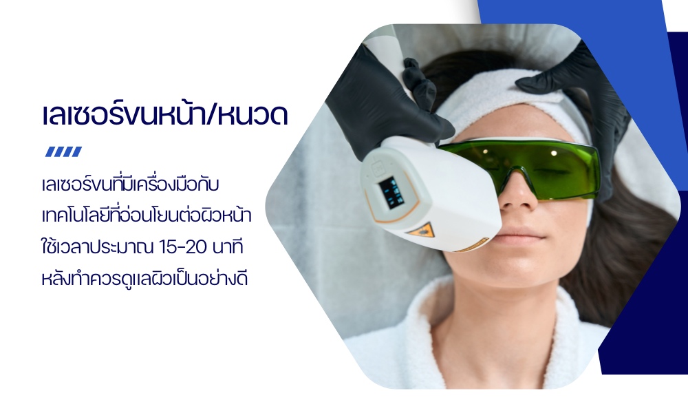 เลเซอร์ขนหน้า/หนวด