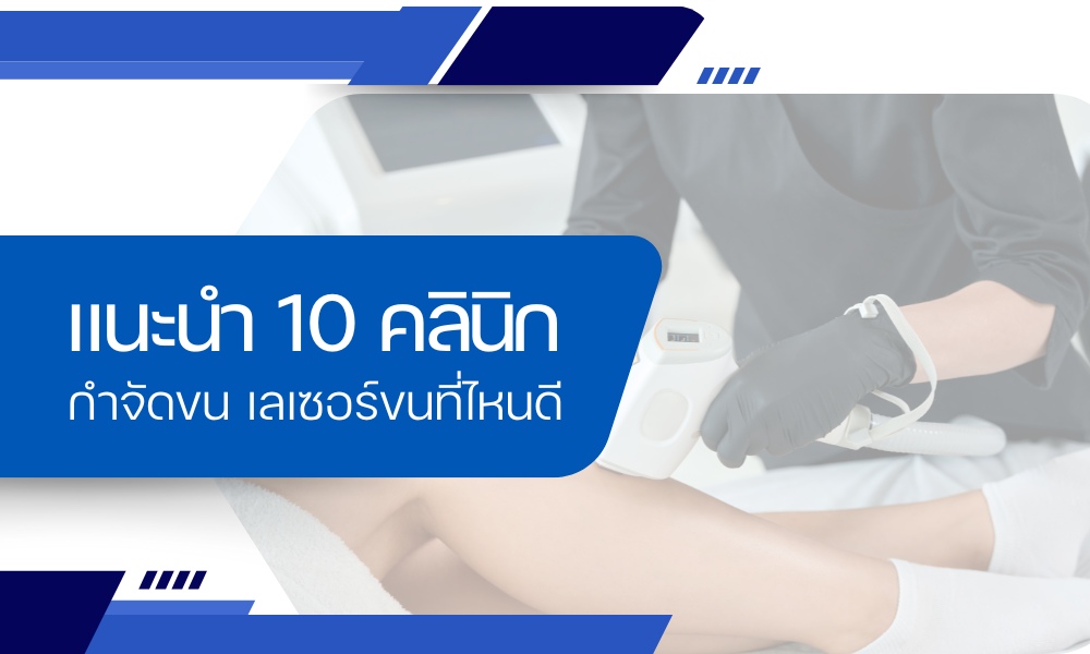 เลเซอร์ขนที่ไหนดี แนะนำ 10 คลินิกกำจัดขนที่ไหนดี