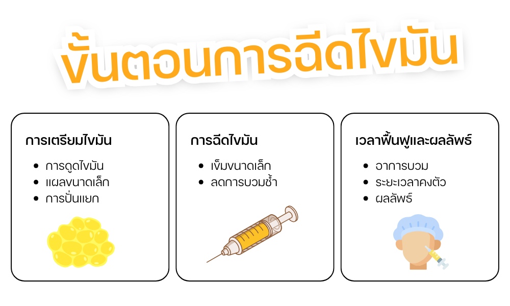 ขั้นตอนการฉีดไขมัน