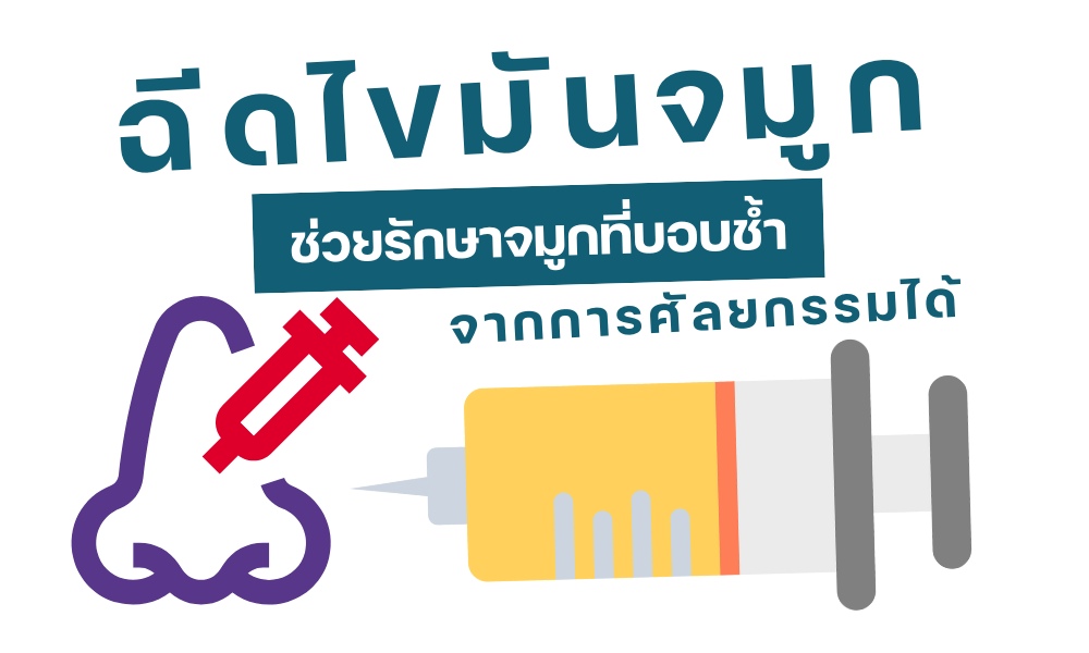 ฉีดไขมันจมูก ช่วยรักษาจมูกที่บอบช้ำจากการศัลยกรรมได้