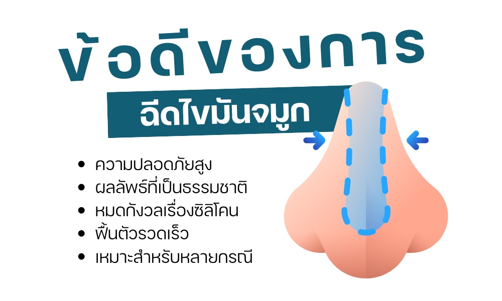 ข้อดีของการ ฉีดไขมันจมูก