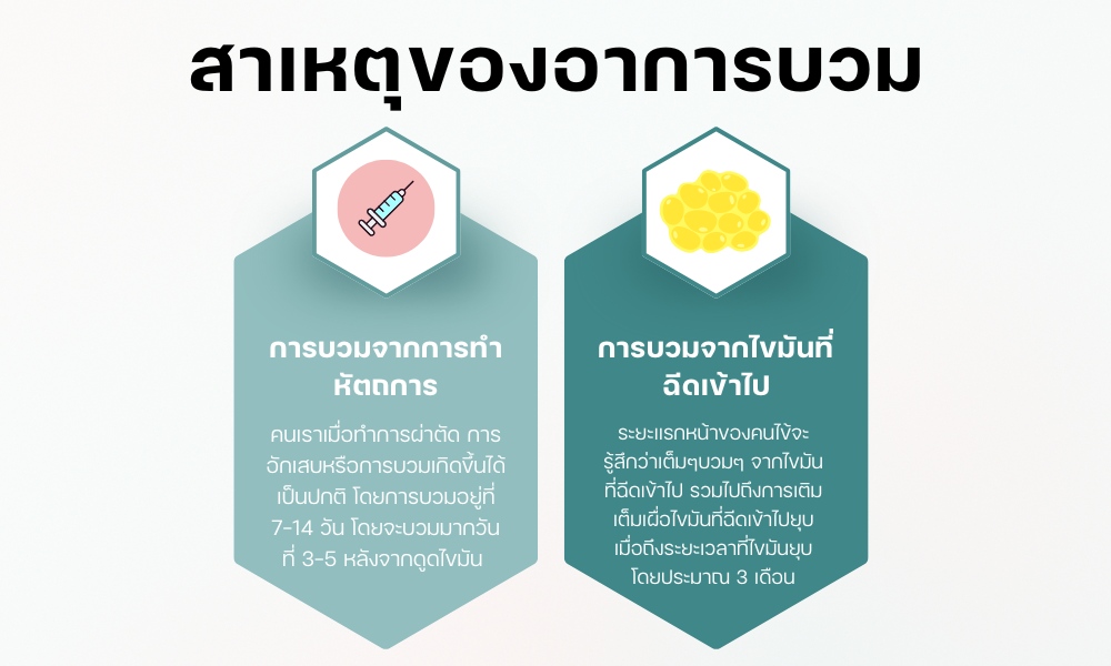 สาเหตุของอาการบวม