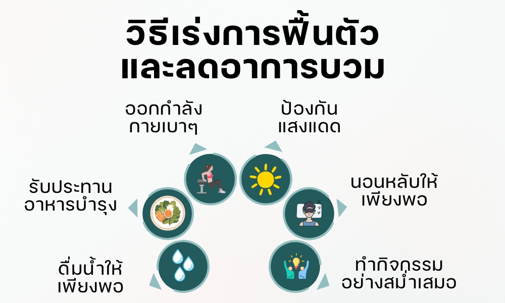 วิธีเร่งการฟื้นตัวและลดอาการบวม