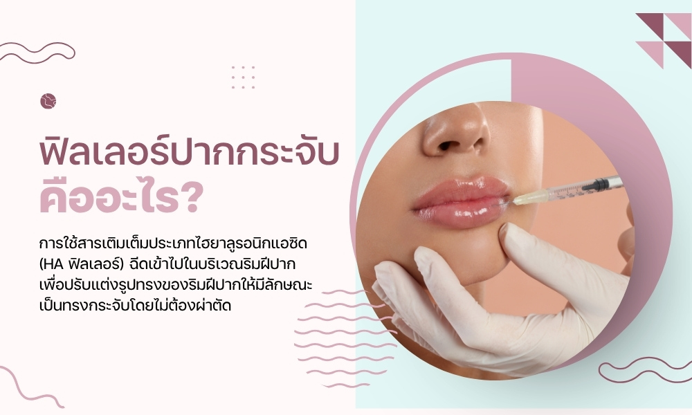 ฟิลเลอร์ปากกระจับคืออะไร?