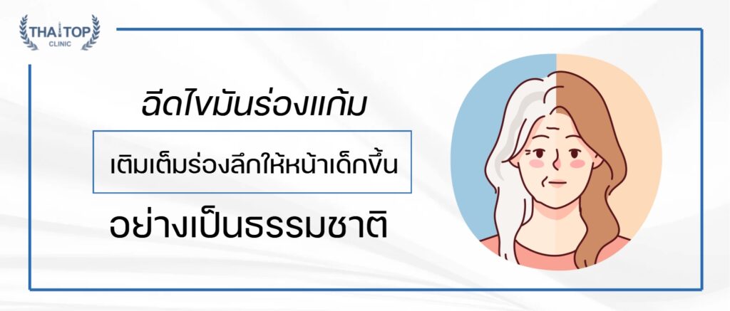 ฉีดไขมันร่องแก้ม เติมเต็มร่องลึกให้หน้าเด็กขึ้นอย่างเป็นธรรมชาติ
