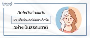 ฉีดไขมันร่องแก้ม เติมเต็มร่องลึกให้หน้าเด็กขึ้นอย่างเป็นธรรมชาติ