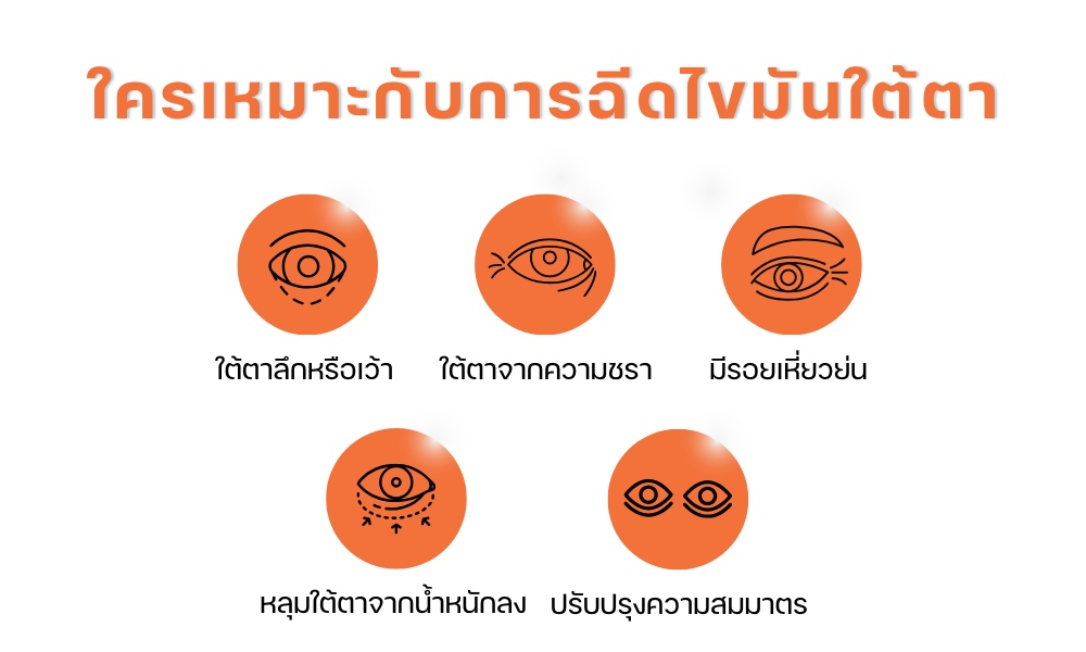 ใครเหมาะกับการฉีดไขมันใต้ตา