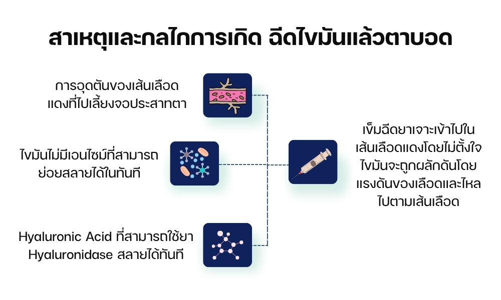 สาเหตุและกลไกการเกิด ฉีดไขมันแล้วตาบอด