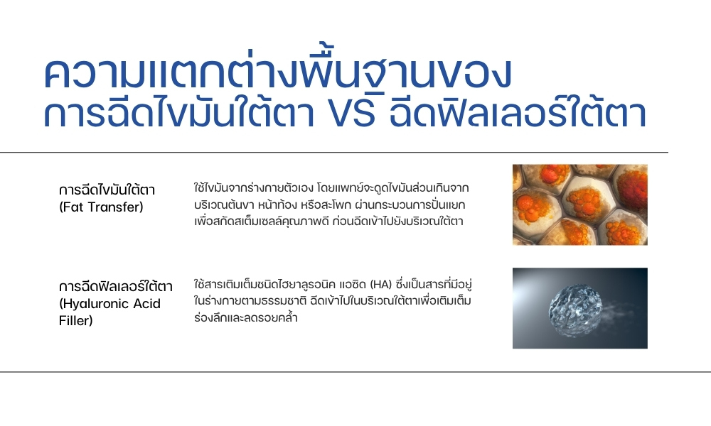 ความแตกต่างพื้นฐานของการฉีดไขมันใต้ตา VS ฉีดฟิลเลอร์ใต้ตา