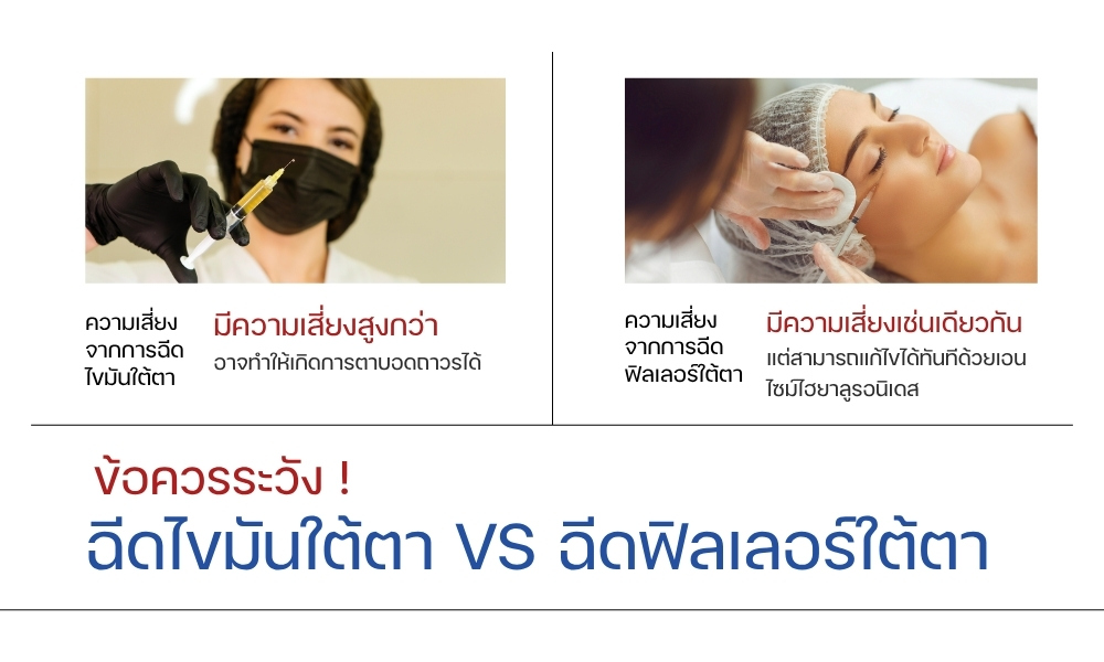 ข้อควรระวัง ฉีดไขมันใต้ตา VS ฉีดฟิลเลอร์ใต้ตา