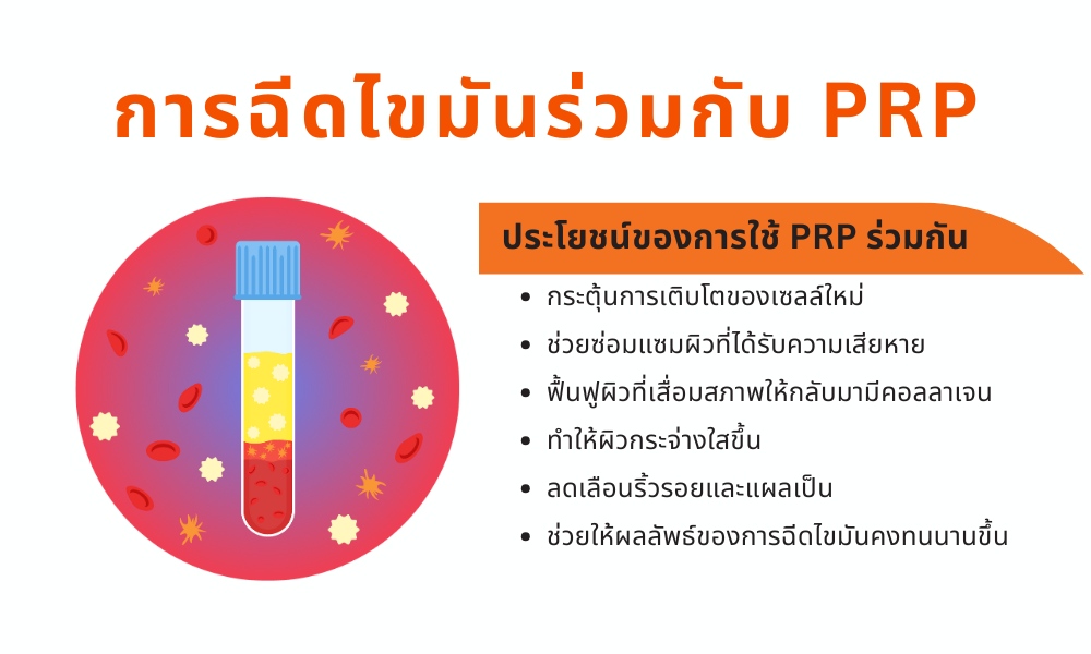 การเลือกแหล่งไขมันที่เหมาะสม