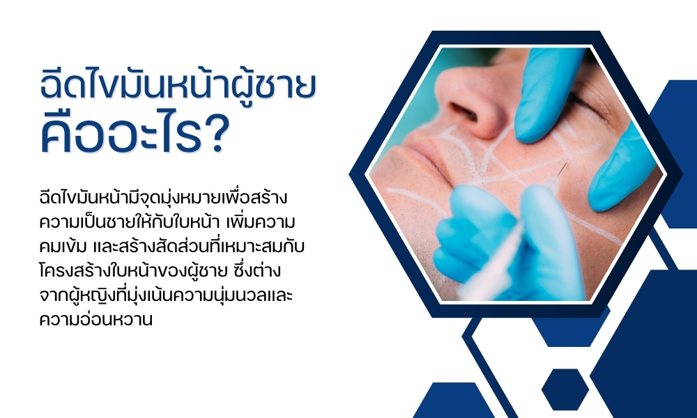 ฉีดไขมันหน้าผู้ชาย คืออะไร?