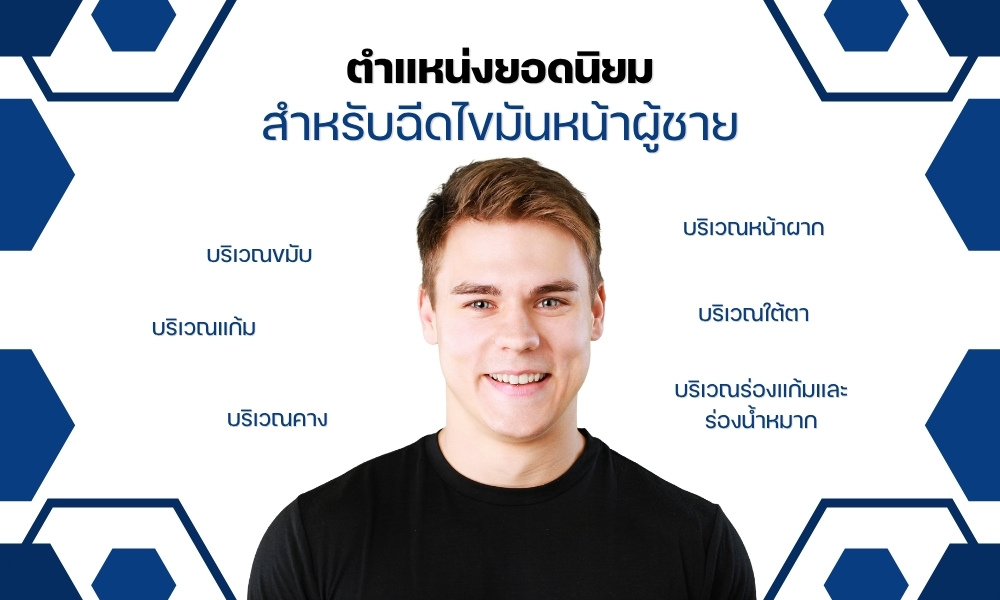 ตำแหน่งยอดนิยมสำหรับฉีดไขมันหน้าผู้ชาย