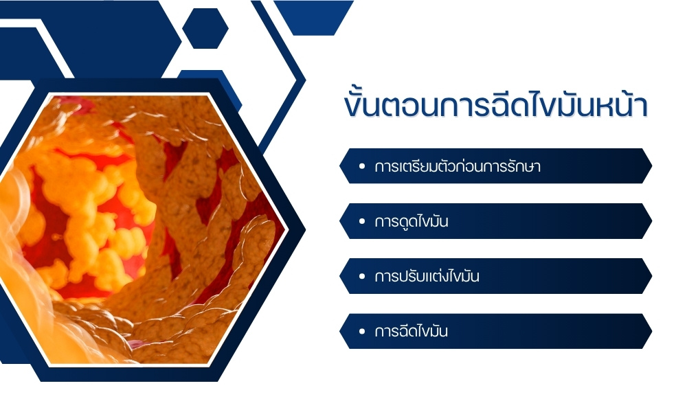 ขั้นตอนการฉีดไขมันหน้า