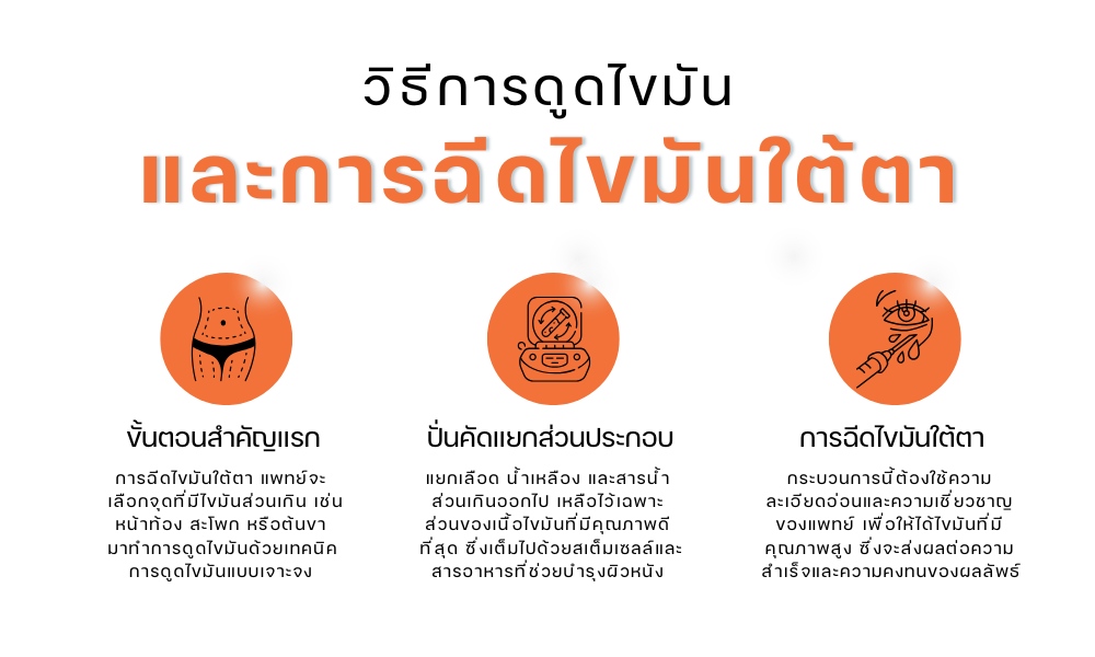 วิธีการดูดไขมันและการฉีดไขมันใต้ตา