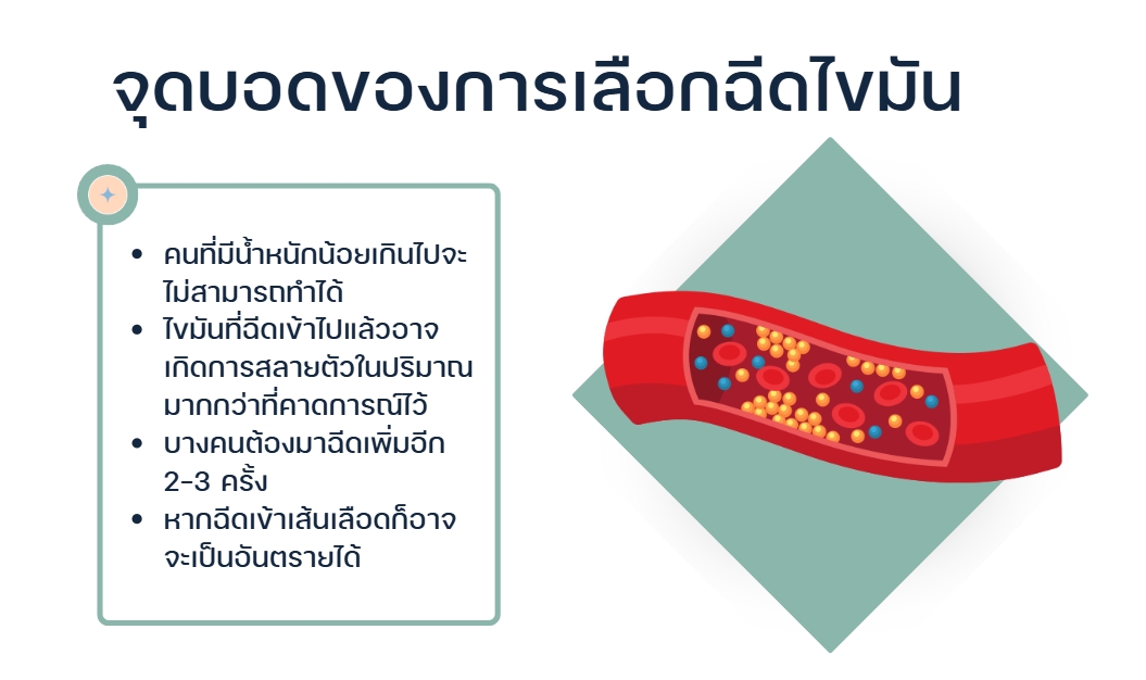 จุดบอดของการเลือกฉีดไขมัน