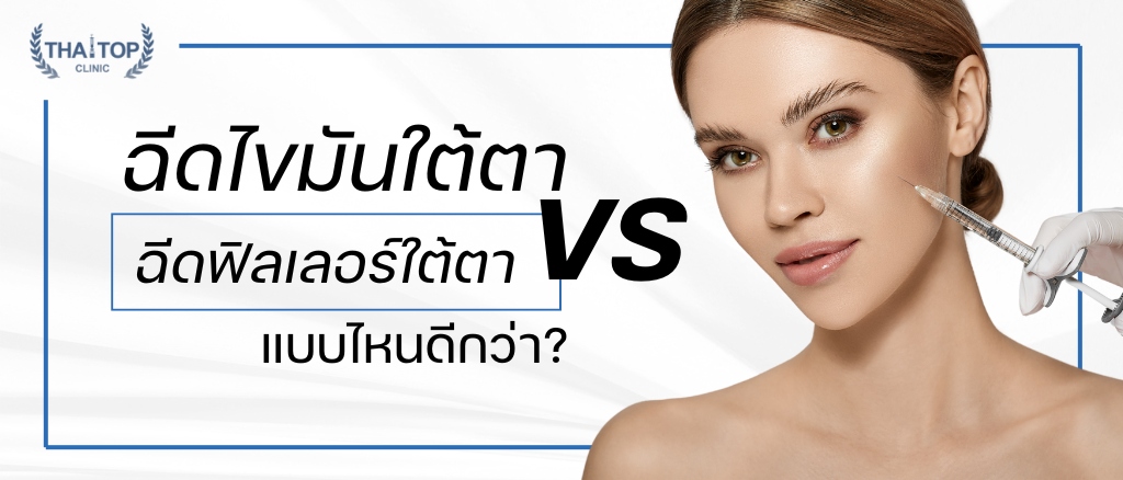 ฉีดไขมันใต้ตา VS ฉีดฟิลเลอร์ใต้ตา แบบไหนดีกว่า
