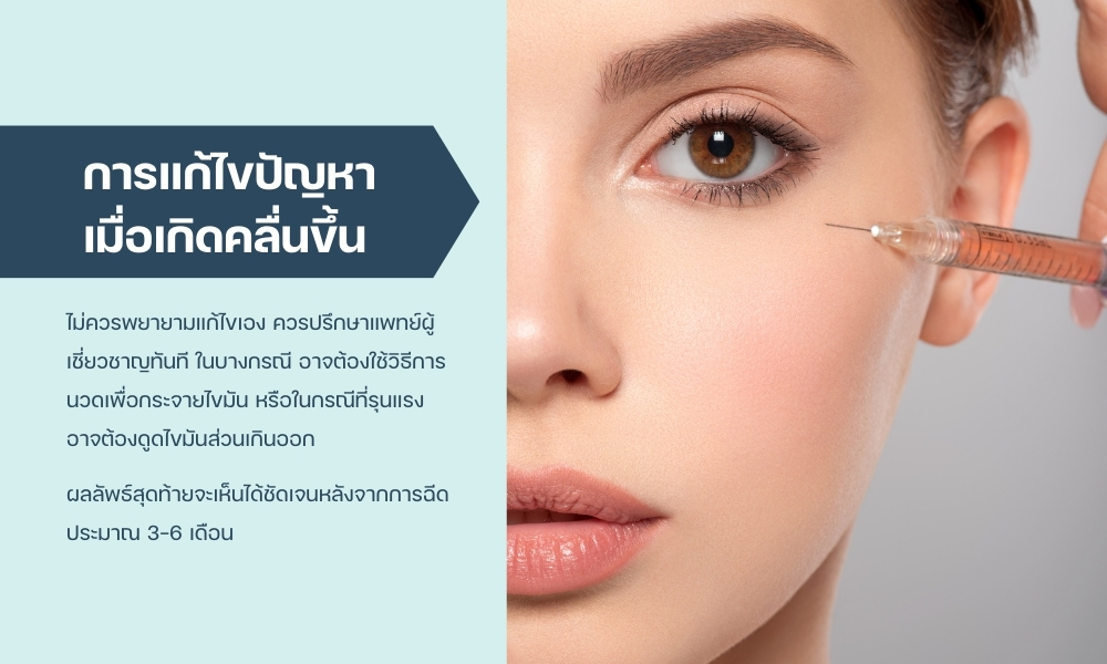 การแก้ไขปัญหาเมื่อเกิดคลื่นขึ้น