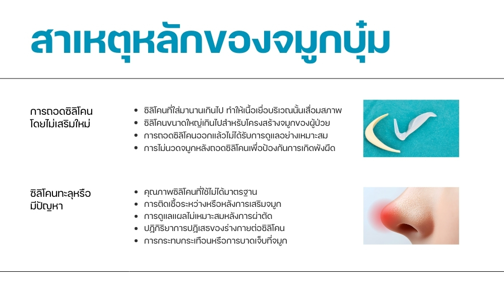 สาเหตุหลักของจมูกบุ๋ม