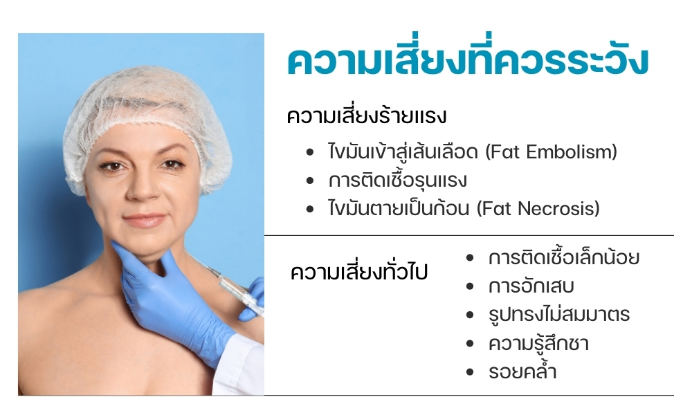 ความเสี่ยงที่ควรระวัง