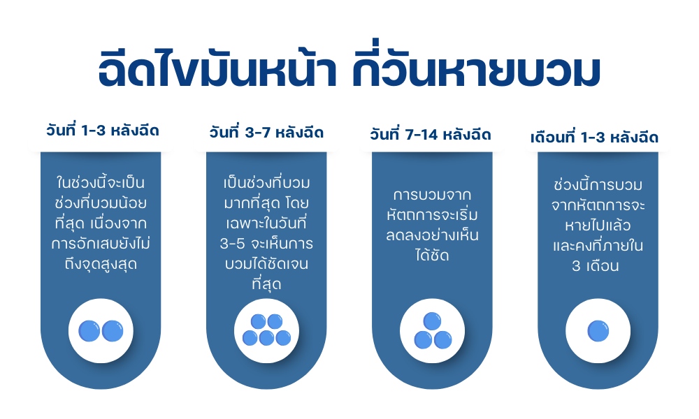 ฉีดไขมันหน้า กี่วันหายบวม