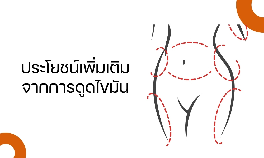 ประโยชน์เพิ่มเติมจากการดูดไขมัน