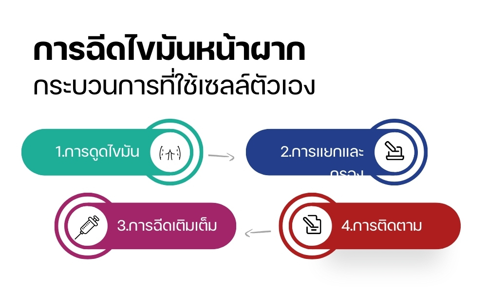 การฉีดไขมันหน้าผาก: กระบวนการที่ใช้เซลล์ตัวเอง