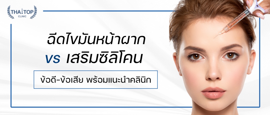 ฉีดไขมันหน้าผาก vs เสริมซิลิโคน ข้อดี-ข้อเสีย พร้อมแนะนำคลินิก