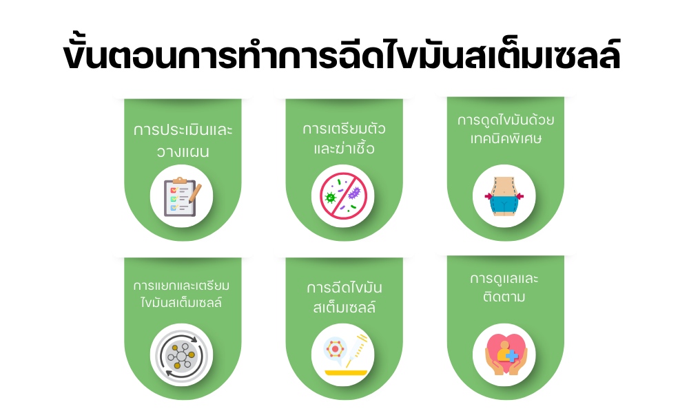 ขั้นตอนการทำการฉีดไขมันสเต็มเซลล์