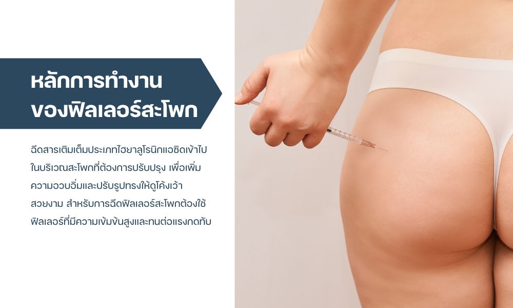 ฟิลเลอร์สะโพก - วิธีเสริมสะโพกแบบไม่ต้องผ่าตัด