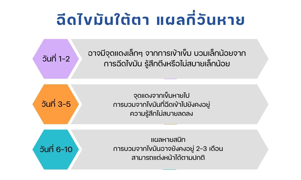 ฉีดไขมันใต้ตา แผลกี่วันหาย