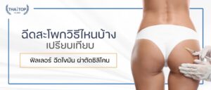 ฉีดสะโพก วิธีไหนบ้าง – เปรียบเทียบฟิลเลอร์ ฉีดไขมัน ผ่าตัดซิลิโคน