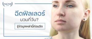 ฉีดฟิลเลอร์บวมกี่วัน? รู้ข้อมูลเหล่านี้ก่อนฉีด