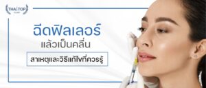 ฉีดฟิลเลอร์แล้วเป็นคลื่น สาเหตุและวิธีแก้ไขที่ควรรู้