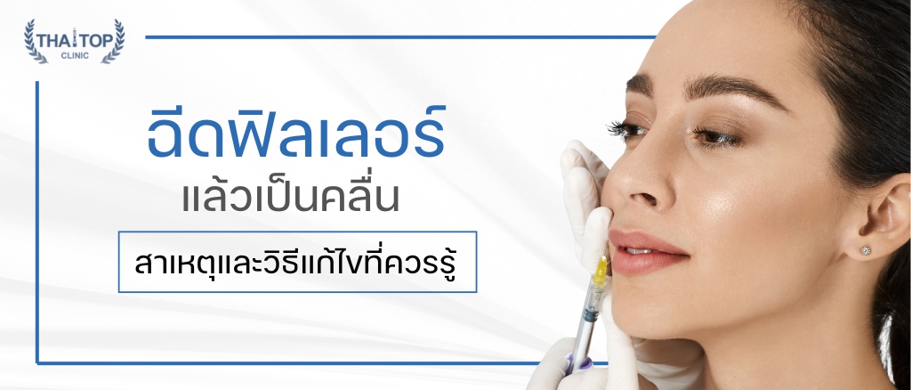 ฉีดฟิลเลอร์แล้วเป็นคลื่น สาเหตุและวิธีแก้ไขที่ควรรู้