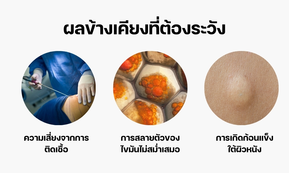 ผลข้างเคียงที่ต้องระวัง